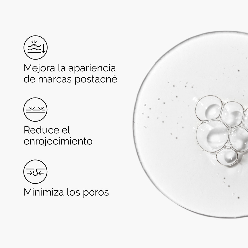 ALOE 2% + NAG SOLUTION  (SUERO PARA TRATAMIENTOS POST ACN&Eacute; CON ALOE)